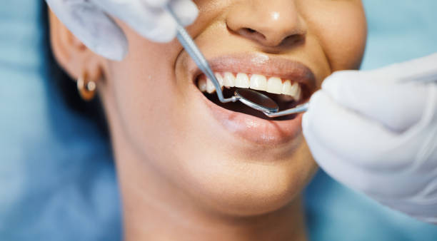 Best Emergency Root Canal Treatment in Kingstown, MD